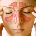 Allergy & Sinus